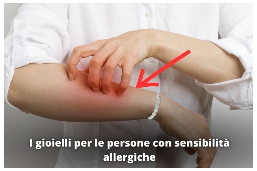 I gioielli per le persone con sensibilità allergiche